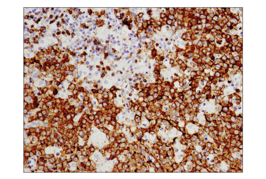 Immunohistochemistry Image 1: CD19 (Intracellular Domain) (D4V4B) Rabbit Monoclonal Antibody (BSA and Azide Free)
