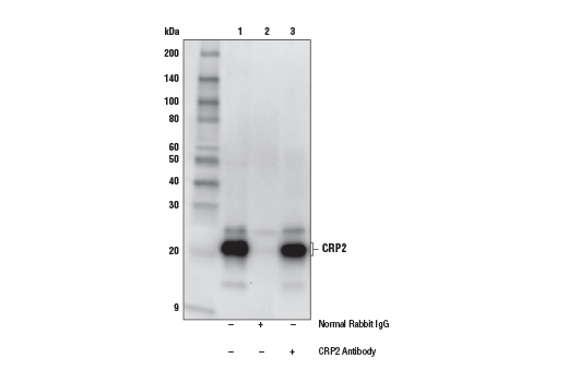 Immunoprecipitation Image 1: CRP2 Antibody