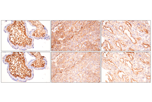 Immunohistochemistry Image 7: Integrin alpha1/CD49a (E9K2J) Rabbit Monoclonal Antibody