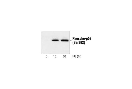 undefined Image 13: Phospho-p53 Antibody Sampler Kit