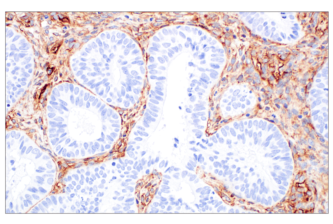 Immunohistochemistry Image 5: CD34 (QBEND/10) Mouse Monoclonal Antibody