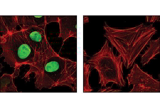Immunofluorescence Image 1: Sox2 (D6D9) Rabbit Monoclonal Antibody (BSA and Azide Free)