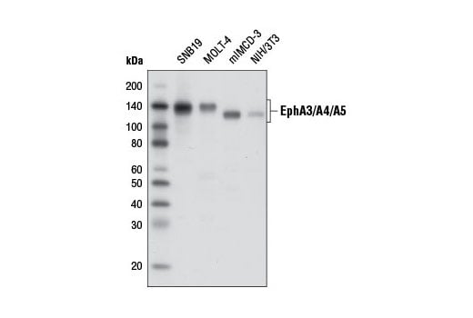 Western Blotting Image 1: EphA3/A4/A5 (D2C11) Rabbit mAb