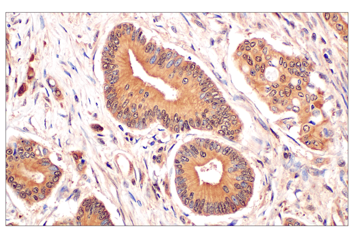 Immunohistochemistry Image 7: MTAP (E5R1I) Rabbit Monoclonal Antibody (BSA and Azide Free)