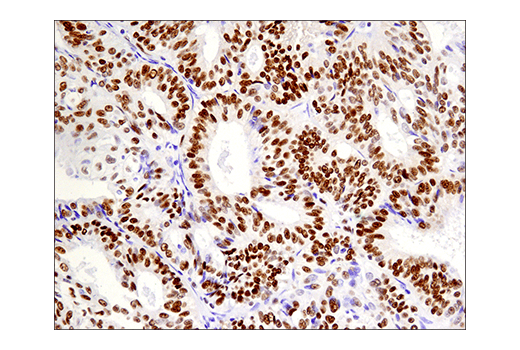 Immunohistochemistry Image 8: Phospho-ATF-2 (Thr71)/ATF-7 (Thr53) (E4A5G) Rabbit Monoclonal Antibody