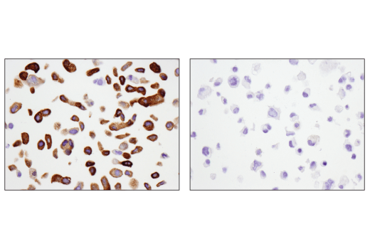 chien様 Tau (D1M9X) XP® Rabbit mAb | Cell Signaling Technology