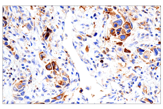 Immunohistochemistry Image 2: Transferrin Receptor/CD71 (10F11) Mouse Monoclonal Antibody