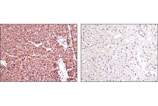 Immunohistochemistry Image 2: Perilipin-1 (D1D8) Rabbit Monoclonal Antibody (BSA and Azide Free)