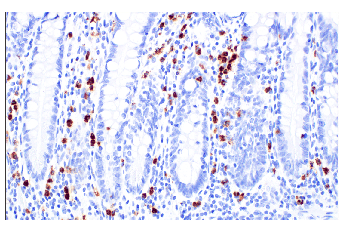 Immunohistochemistry Image 1: Eosinophil peroxidase (F3C2H) Rabbit Monoclonal Antibody