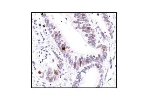 Immunohistochemistry Image 2: Phospho-Histone H2A.X (Ser139) (20E3) Rabbit Monoclonal Antibody (BSA and Azide Free)