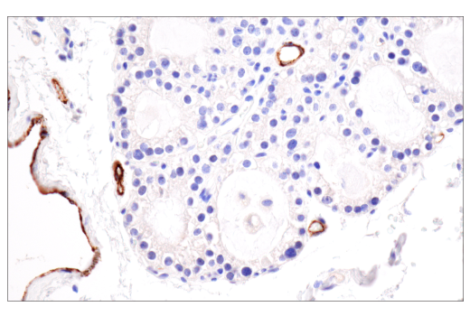 Immunohistochemistry Image 7: CD62P/P-Selectin (E8Q1W) Rabbit Monoclonal Antibody