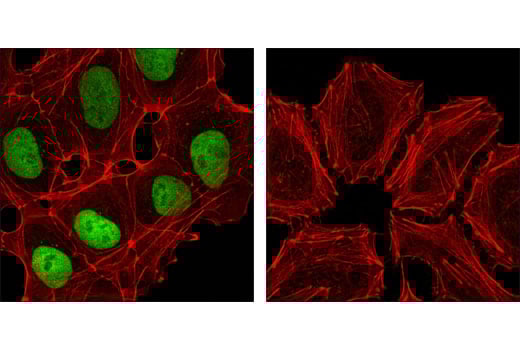 undefined Image 7: StemLight<sup>™</sup> Pluripotency Transcription Factor IF Antibody Sampler Kit