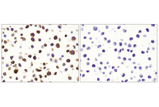 Immunohistochemistry Image 7: CD68 (D4B9C) Rabbit Monoclonal Antibody (BSA and Azide Free)