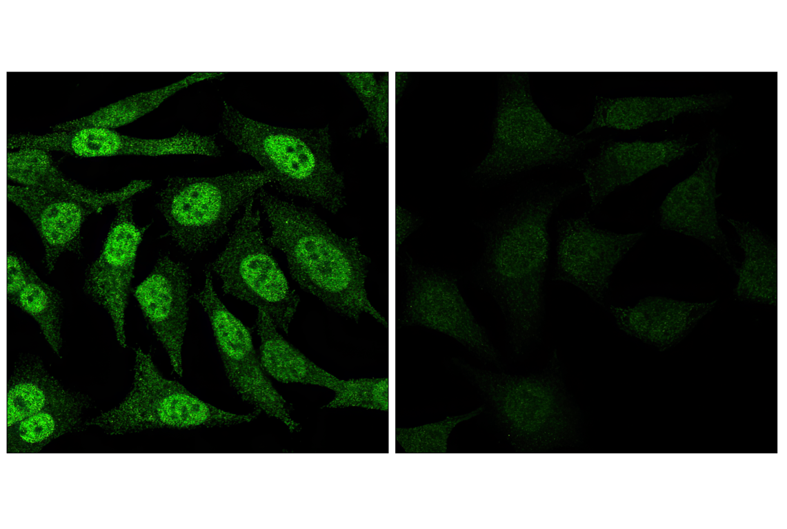 Immunofluorescence Image 1: Phospho-Stat3 (Tyr705) (D3A7) XP<sup>®</sup> Rabbit mAb (BSA and Azide Free)