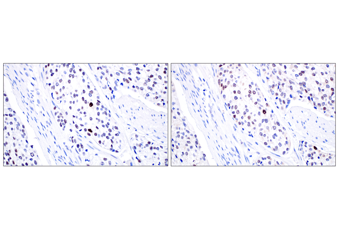 Immunohistochemistry Image 8: MDM2 (F7W7X) Rabbit Monoclonal Antibody