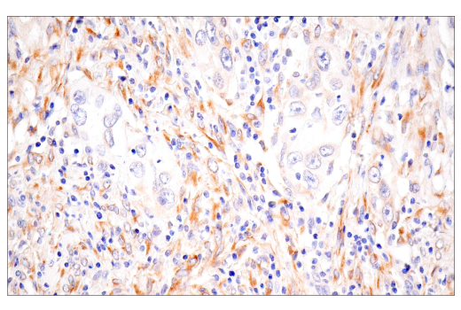 Immunohistochemistry Image 2: CTHRC1 (E8M9S) Rabbit Monoclonal Antibody
