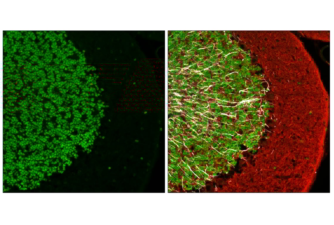 Immunofluorescence Image 3: NeuroD1 (E3E4F) Rabbit Monoclonal Antibody