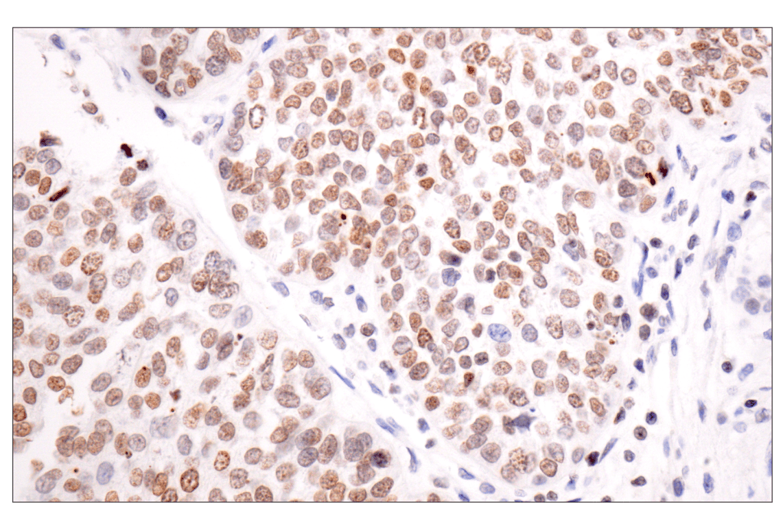 Immunohistochemistry Image 2: Acetyl-Histone H4 (Lys16) (E2B8W) Rabbit Monoclonal Antibody (BSA and Azide Free)