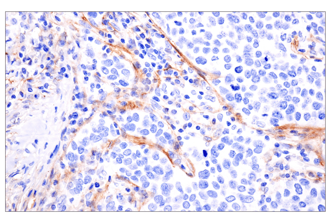 Immunohistochemistry Image 2: LRRC15 (E4X8J) Rabbit Monoclonal Antibody