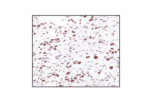Immunohistochemistry Image 1: Phospho-Threonine-Proline Mouse Monoclonal Antibody (P-Thr-Pro-101)