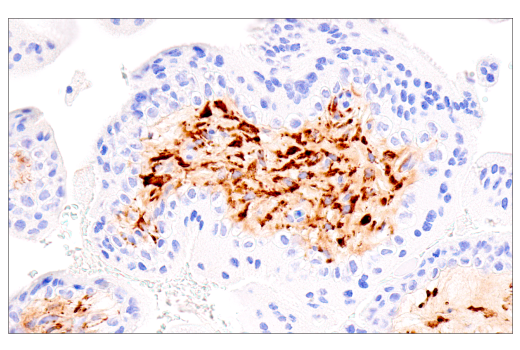 Immunohistochemistry Image 1: COL5A1 (E6U9W) Rabbit Monoclonal Antibody (BSA and Azide Free)