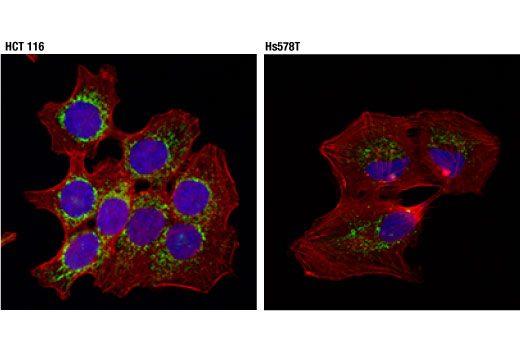 Immunofluorescence Image 1: TRAP1/HSP75 (D3D7N) Rabbit Monoclonal Antibody