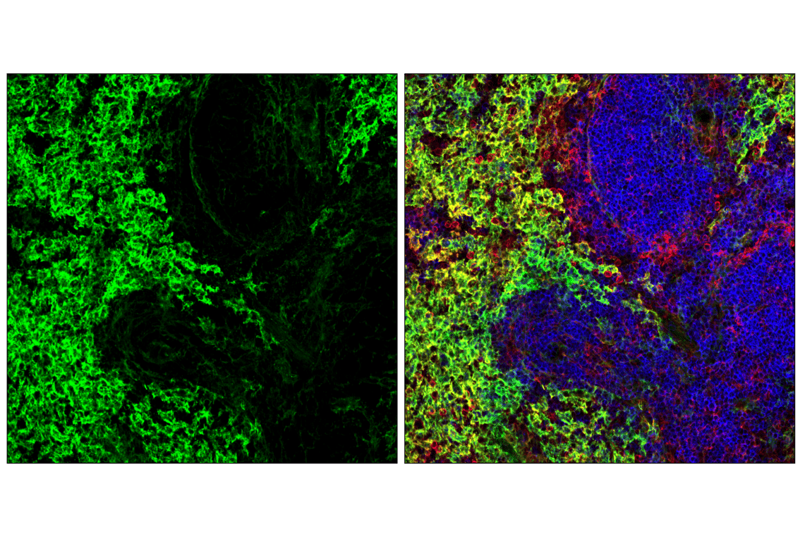 Immunofluorescence Image 2: Axl (F3K7B) Rabbit Monoclonal Antibody