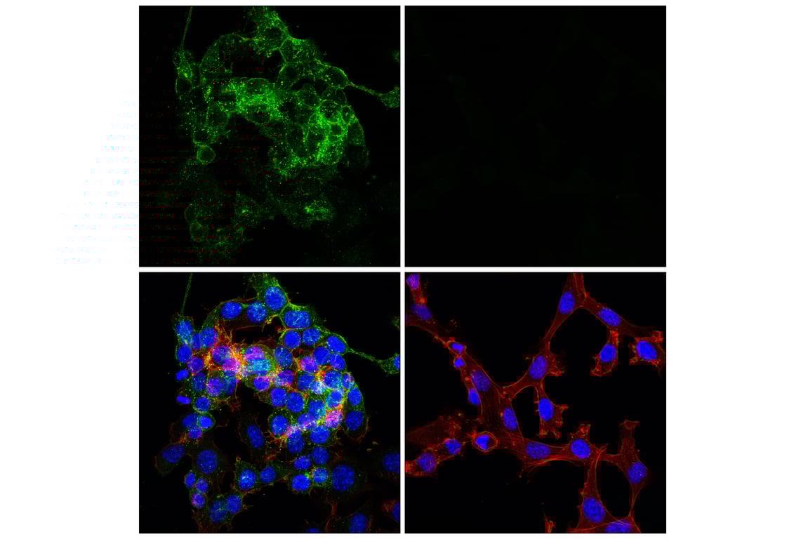 Immunofluorescence Image 1: GAP43 (E6L2W) Mouse Monoclonal Antibody