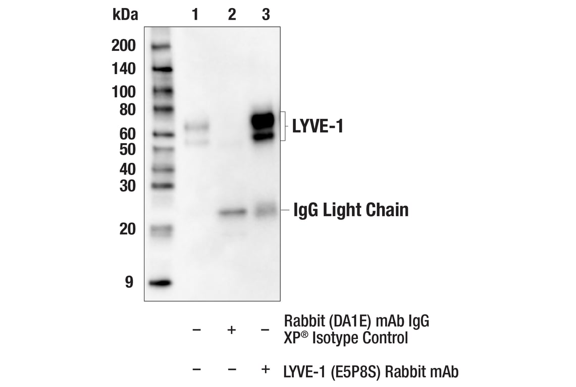 Immunoprecipitation Image 1: LYVE-1 (E5P8S) Rabbit Monoclonal Antibody