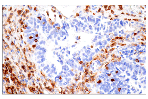 Immunohistochemistry Image 4: CD43 (MT1) Mouse Monoclonal Antibody