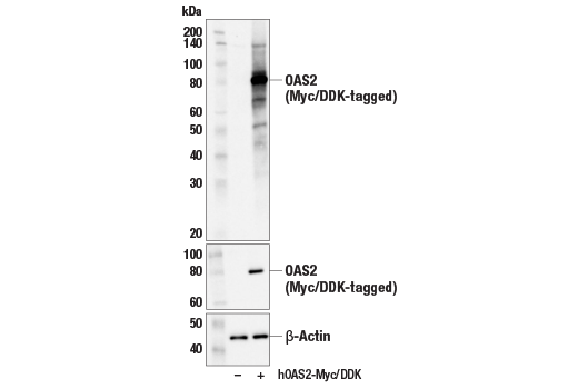 Western Blotting Image 2: OAS2 (E2G4K) Rabbit Monoclonal Antibody