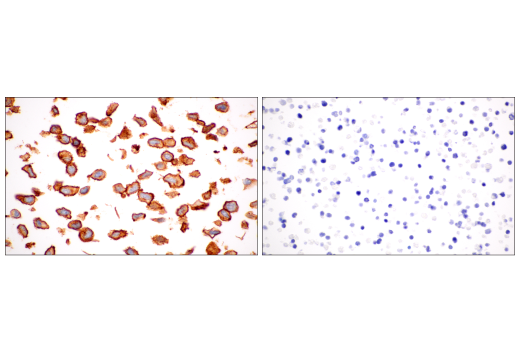 Immunohistochemistry Image 14: PODXL (E8O1S) Rabbit Monoclonal Antibody (BSA and Azide Free)