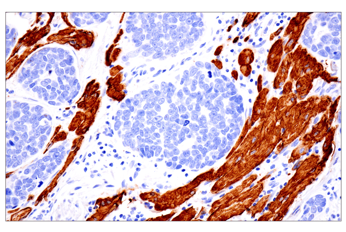 Immunohistochemistry Image 1: Desmin (F5V4I) Rabbit Monoclonal Antibody
