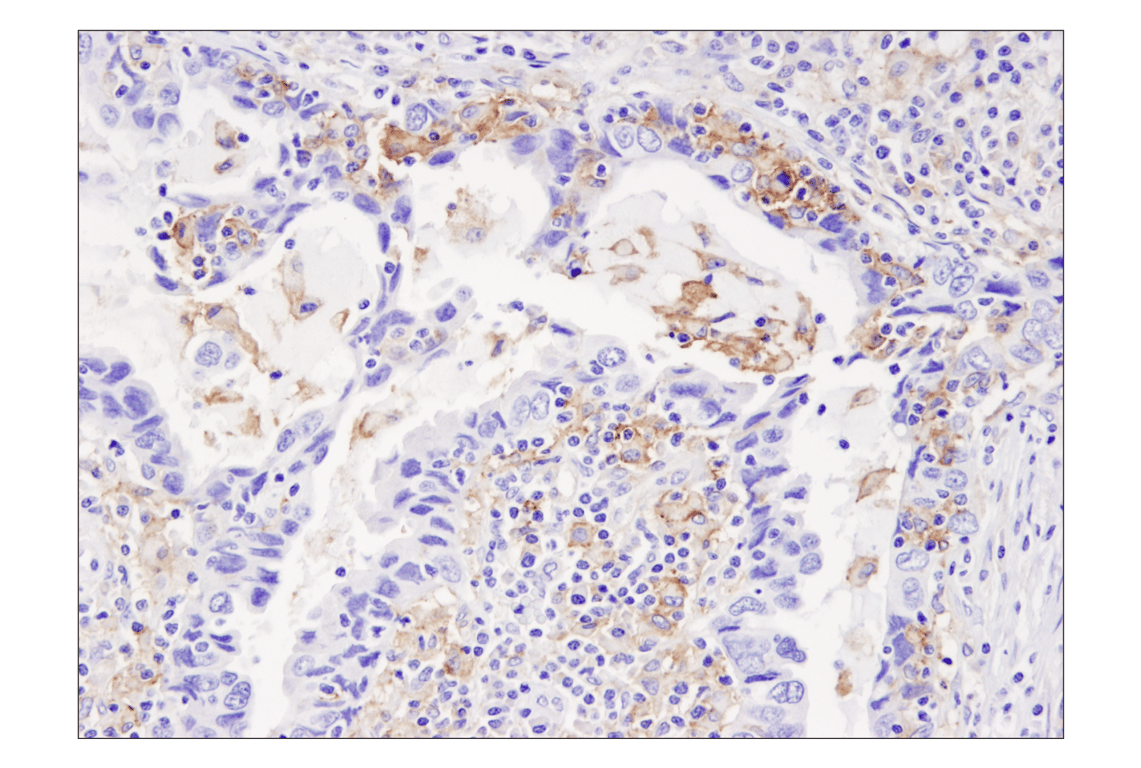 Immunohistochemistry Image 4: PD-L1 (405.9A11) Mouse Monoclonal Antibody (BSA and Azide Free)