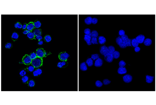 Immunofluorescence Image 1: CD20 (E7B7T) Rabbit Monoclonal Antibody (BSA and Azide Free)
