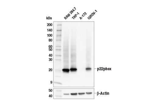 Western Blotting Image 1: p22phox (E9N8W) Rabbit mAb