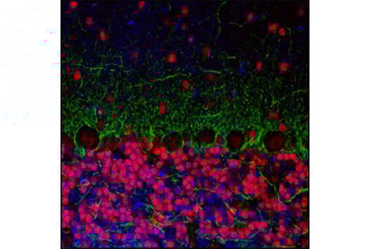 Immunofluorescence Image 1: CREB (48H2) Rabbit Monoclonal Antibody