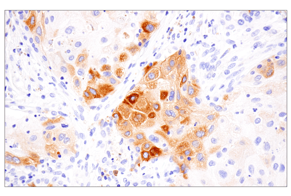 Immunohistochemistry Image 3: COL17A1 (F5U1Z) Rabbit Monoclonal Antibody