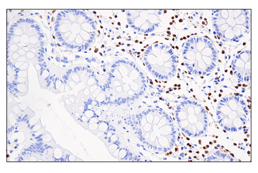 Immunohistochemistry Image 2: IRF-4 (E8H3S) XP<sup>®</sup> Rabbit mAb