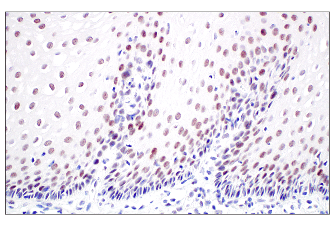 Immunohistochemistry Image 5: MDM2 (F7W7X) Rabbit Monoclonal Antibody (BSA and Azide Free)
