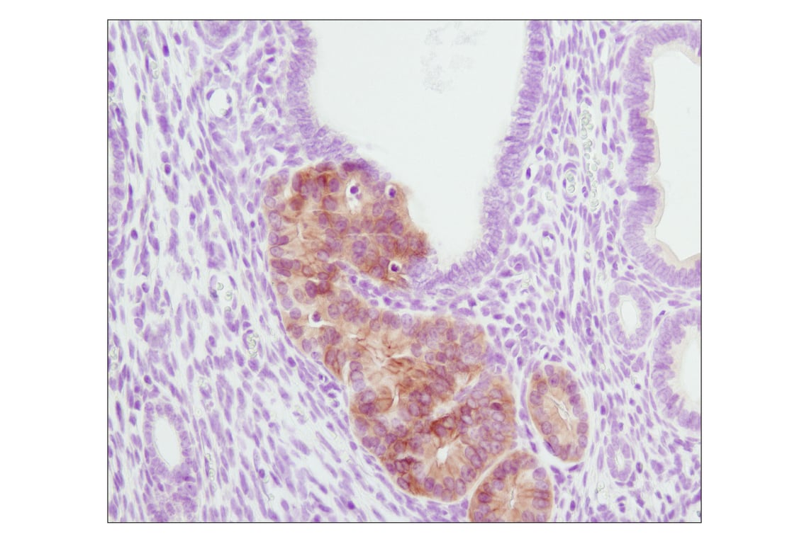 Immunohistochemistry Image 3: Phospho-Akt (Ser473) (D9E) XP<sup>®</sup> Rabbit mAb (BSA and Azide Free)