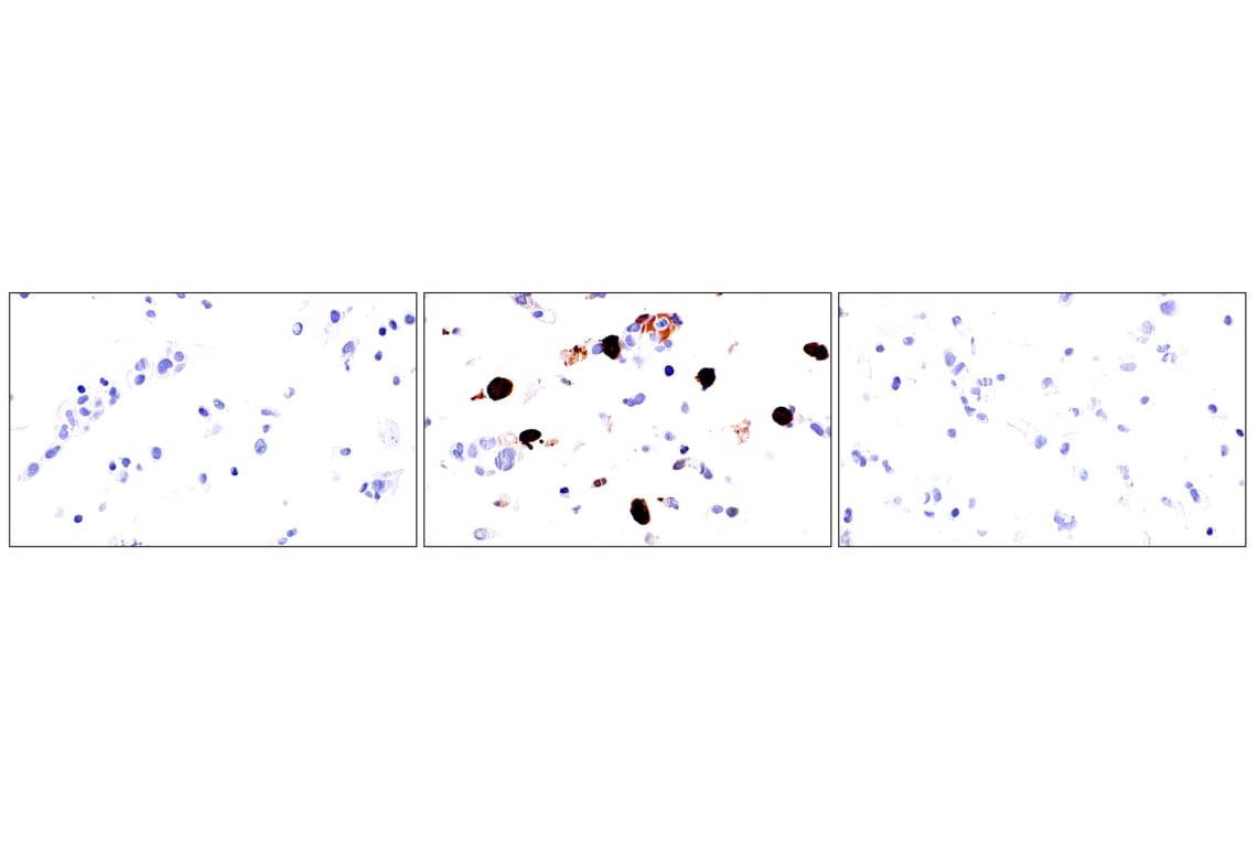 Immunohistochemistry Image 15: Phospho-YAP (Ser61) (E4Q8S) Rabbit Monoclonal Antibody