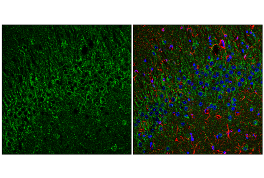 undefined Image 5: Organelle Localization IF Antibody Sampler Kit
