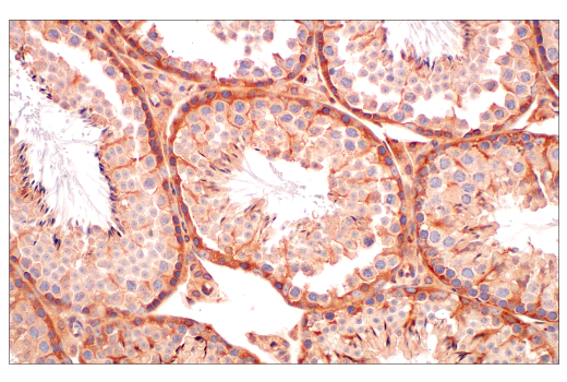 Immunohistochemistry Image 6: ILK1 (4G9) Rabbit Monoclonal Antibody