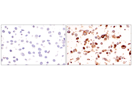 Immunohistochemistry Image 7: CCL5/RANTES (E9S2K) Rabbit mAb