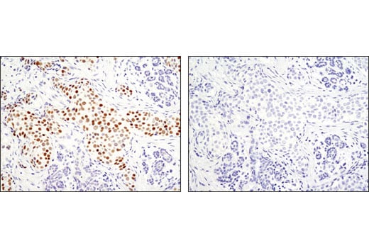 Immunohistochemistry Image 1: GATA-3 (D13C9) Rabbit Monoclonal Antibody