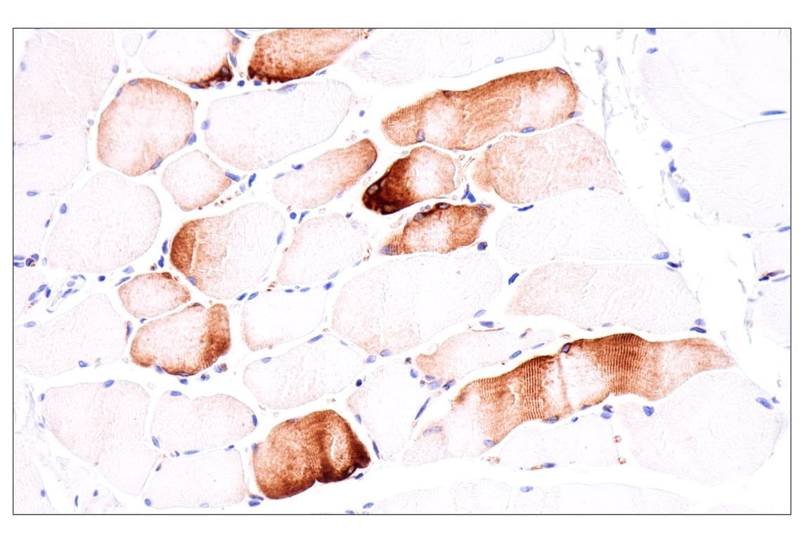Immunohistochemistry Image 10: Nestin (E5C7I) Rabbit Monoclonal Antibody (BSA and Azide Free)
