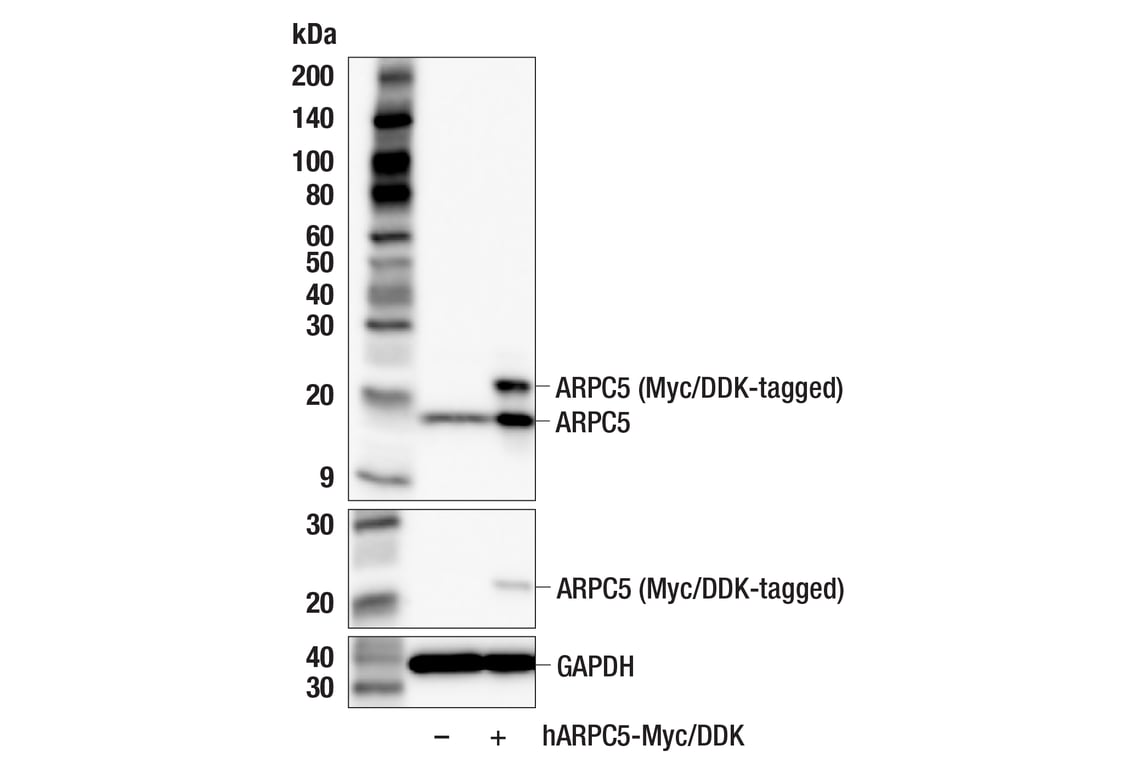 Western Blotting Image 2: ARPC5 (F5F6V) Rabbit Monoclonal Antibody