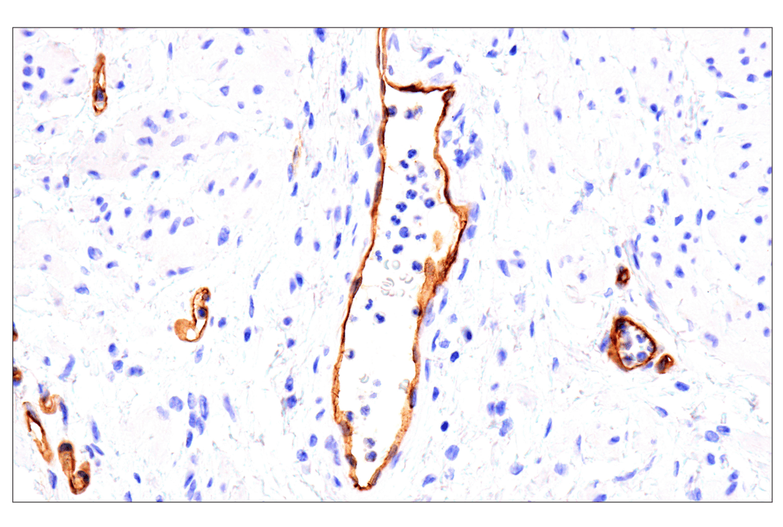 Immunohistochemistry Image 4: EMCN (E3Z4D) Rabbit Monoclonal Antibody (BSA and Azide Free)