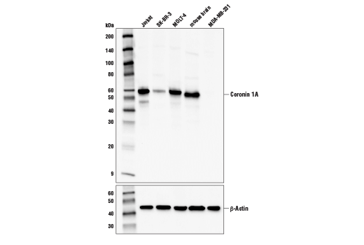 Western Blotting Image 1: Coronin 1A (D7M3N) Rabbit mAb